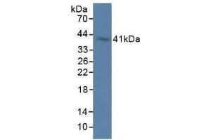 Figure. (OAS1 antibody  (AA 139-358))