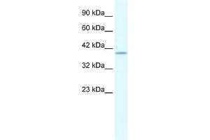 PHKG2 antibody used at 0. (PHKG2 antibody)