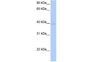 ZNF385D antibody used at 0. (ZNF385D antibody  (C-Term))