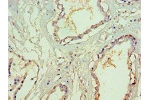 Immunohistochemistry of paraffin-embedded human prostate tissue using ABIN7170623 at dilution of 1:100 (SF3B3 antibody  (AA 948-1217))