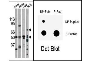 Image no. 1 for anti-Checkpoint Kinase 1 (CHEK1) (pSer317) antibody (ABIN358109) (CHEK1 antibody  (pSer317))