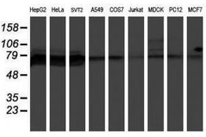 Image no. 3 for anti-Protein Phosphatase 1, Regulatory (Inhibitor) Subunit 15A (PPP1R15A) antibody (ABIN1498364) (GADD34 antibody)