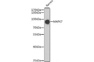 Western blot analysis of extracts of Ramos cells using MAPK7 Polyclonal Antibody at dilution of 1:1000. (MAPK7 antibody)