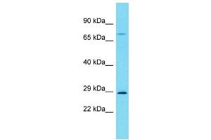 Host:  Rabbit  Target Name:  Rrp7a  Sample Type:  Rat Spleen lysates  Antibody Dilution:  1. (RRP7A antibody  (C-Term))