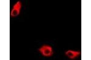 Immunofluorescent analysis of KIF2B staining in A549 cells. (KIF2B antibody)