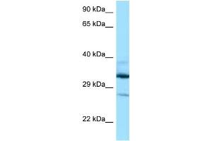 WB Suggested Anti-DOHH Antibody Titration: 1. (DOHH antibody  (N-Term))