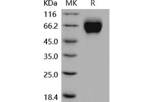 Interleukin 18 Receptor 1 (IL18R1) protein (His tag)