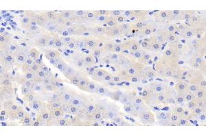 Detection of SDH in Bovine Liver Tissue using Polyclonal Antibody to Sorbitol Dehydrogenase (SDH) (SORD antibody  (AA 4-344))