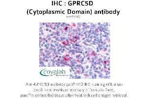Image no. 1 for anti-G Protein-Coupled Receptor, Family C, Group 5, Member D (GPRC5D) (1st Cytoplasmic Domain) antibody (ABIN1735222) (GPRC5D antibody  (1st Cytoplasmic Domain))