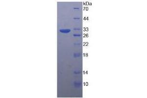 Image no. 1 for Tubulin, beta (TUBB) (AA 170-419) (Active) protein (His tag) (ABIN6239912)