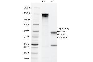 SDS-PAGE Analysis Purified EpCAM Mouse Monoclonal Antibody (PAN-EpCAM). (EpCAM antibody)