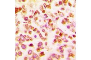 Immunohistochemical analysis of BCL6 staining in human tonsil formalin fixed paraffin embedded tissue section. (BCL6 antibody  (C-Term))