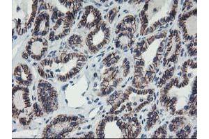 Image no. 9 for anti-Arachidonate 15-Lipoxygenase (ALOX15) antibody (ABIN1496359)