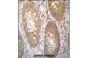 DHRS7B Antibody (Center) (ABIN657263 and ABIN2846358) immunohistochemistry analysis in formalin fixed and paraffin embedded human colon tissue followed by peroxidase conjugation of the secondary antibody and DAB staining. (DHRS7B antibody  (AA 133-161))