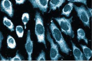 Immunofluorescence staining of human endothelial cells. (EIF2AK2 antibody  (AA 117-250))