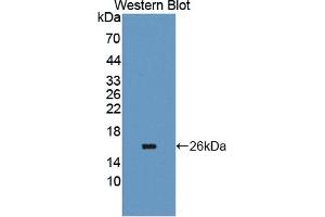 Detection of Recombinant CEACAM6, Human using Polyclonal Antibody to Carcinoembryonic Antigen Related Cell Adhesion Molecule 6 (CEACAM6) (CEACAM6 antibody  (AA 35-142))