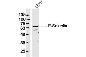 Mouse liver lysates probed with E-selectin Polyclonal Antibody, unconjugated  at 1:300 overnight at 4°C followed by a conjugated secondary antibody at 1:10000 for 90 minutes at 37°C. (Selectin E/CD62e antibody  (AA 501-612))