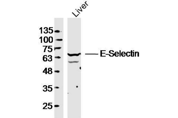 Selectin E/CD62e antibody  (AA 501-612)
