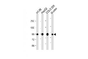 All lanes : Anti-Villin-1 Antibody (N-term) at 1:2000 dilution Lane 1: HT-29 whole cell lysate Lane 2: HepG2 whole cell lysate Lane 3: COLO 205 whole cell lysate Lane 4: Mouse colon lysate Lysates/proteins at 20 μg per lane. (Villin 1 antibody  (N-Term))