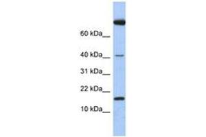 Image no. 1 for anti-Interleukin 4 (IL4) (C-Term) antibody (ABIN6743767) (IL-4 antibody  (C-Term))