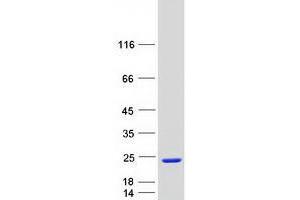 Validation with Western Blot
