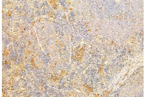 ABIN6264193 and ABIN6269202 at 1/100 staining Rat spleen tissue by IHC-P. (PI3K p85/p55 antibody  (Internal Region))