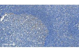 IHC analysis of DRP1/DNM1L using anti-DRP1/DNM1L antibody (ABIN7602180).