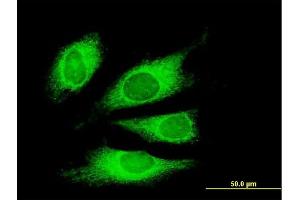 Immunofluorescence of monoclonal antibody to TG on HeLa cell. (Thyroglobulin antibody  (AA 2659-2768))