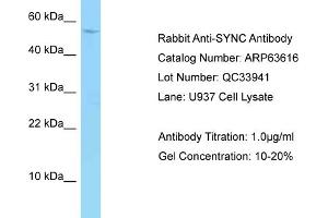Western Blotting (WB) image for anti-Syncoilin (Sync) (C-Term) antibody (ABIN2789566) (Syncoilin antibody  (C-Term))