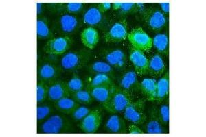 IF analysis of CD59 using anti-CD59 antibody (ABIN7600941). (CD59 antibody  (AA 26-102))