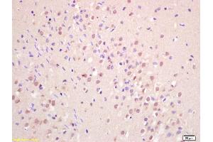 Formalin-fixed and paraffin embedded rat brain labeled with Anti-GNAQ/G? (GNAQ antibody  (AA 51-150))