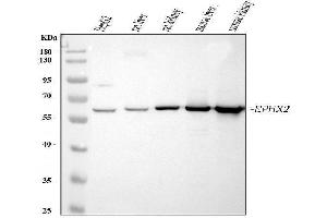 Western blot analysis of EPHX2 using anti-EPHX2 antibody (ABIN4886572).