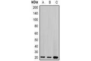 Western Blotting (WB) image for anti-Centrin, EF-Hand Protein, 2 (CETN2) (full length) antibody (ABIN6005128) (CETN2 antibody  (full length))