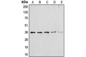 Western blot analysis of Annexin A1 expression in HEK293T (A), NIH3T3 (B), THP1 (C), Molt4 (D), HepG2 (E) whole cell lysates. (Annexin a1 antibody  (Center))