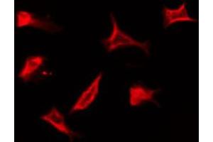 ABIN6274317 staining HuvEc by IF/ICC. (SSBP1 antibody  (Internal Region))