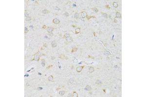 Immunohistochemistry of paraffin-embedded rat brain using SLC2A13 antibody. (SLC2A13 antibody  (AA 564-648))