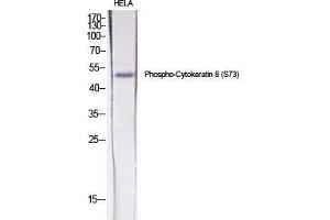 Western Blot (WB) analysis of specific cells using Phospho-Cytokeratin 8 (S73) Polyclonal Antibody. (KRT8 antibody  (pSer73))