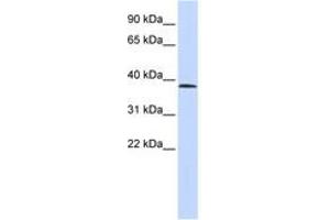 Image no. 1 for anti-Suppressor of Variegation 4-20 Homolog 1 (SUV420H1) (C-Term) antibody (ABIN6742516) (SUV420H1 antibody  (C-Term))