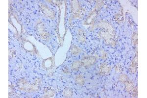 Immunohistochemistry (Paraffin-embedded Sections) (IHC (p)) image for anti-Signal Transducer and Activator of Transcription 2, 113kDa (STAT2) (AA 151-250) antibody (ABIN738246)