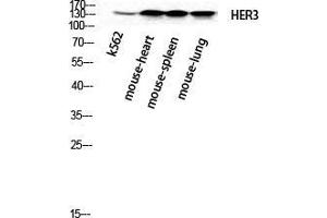 Western Blot (WB) analysis of k562 Mouse Heart Mouse Spleen Mouse Lung cells using ErbB-3 Polyclonal Antibody. (ERBB3 antibody  (N-Term))