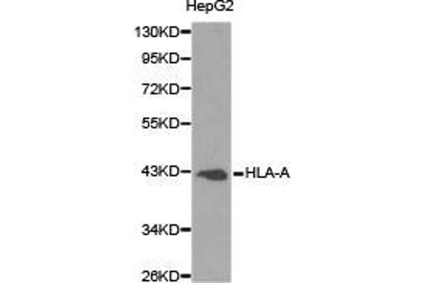 HLA-A anticorps