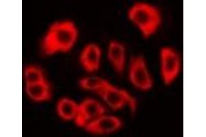 Immunofluorescent analysis of RPS3A staining in MCF7 cells. (RPS3A antibody)
