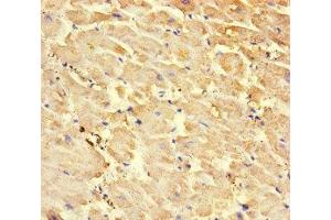 Immunohistochemistry of paraffin-embedded human heart tissue using ABIN7168509 at dilution of 1:100