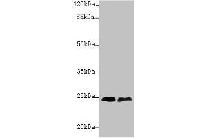 Western blot All lanes: SERTAD1 antibody at 6 μg/mL Lane 1: SH-SY5Y whole cell lysate Lane 2: A549 whole cell lysate Secondary Goat polyclonal to rabbit IgG at 1/10000 dilution Predicted band size: 25 kDa Observed band size: 25 kDa