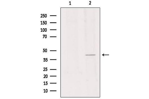 GPR34 Antikörper  (C-Term)