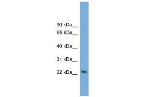 Western Blot showing RAB15 antibody used at a concentration of 1-2 ug/ml to detect its target protein. (RAB15 antibody  (Middle Region))