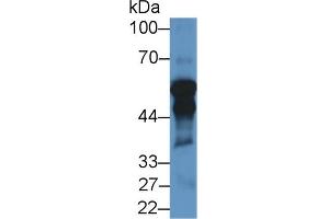 Detection of CYP11A1 in Rat Testis lysate using Polyclonal Antibody to Cytochrome P450 11A1 (CYP11A1) (CYP11A1 antibody  (AA 44-287))