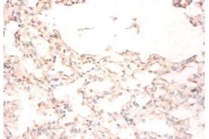 Immunohistochemistry of paraffin-embedded human lung tissue using ABIN7159501 at dilution of 1:50 (STEAP1 antibody  (AA 3-69))