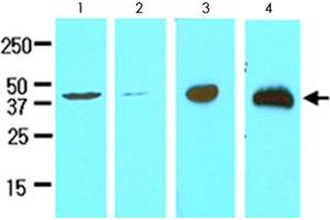 Cell lysates of HeLa (lane 1), MCF-7 (lane 2), LNCaP (lane 3) and mouse brain (lane 4) (30 ug) were resolved by SDS-PAGE and probed with TREM2 monoclonal antibody, clone 2B5  (1:500). (TREM2 antibody  (AA 19-161))
