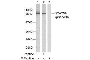 Image no. 2 for anti-Signal Transducer and Activator of Transcription 5A (STAT5A) (pSer780) antibody (ABIN196699) (STAT5A antibody  (pSer780))